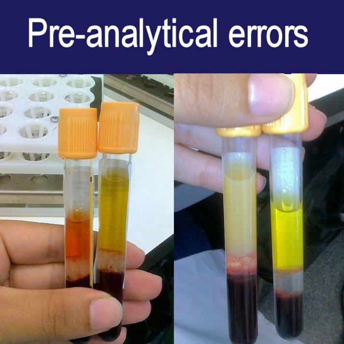 Analytical errors laboratory post